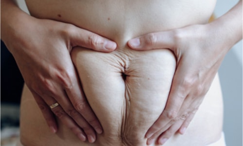 This Is Why Women Are Annoyed With The Oscars - belly